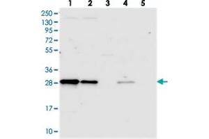 Western blot analysis of Lane 1: RT-4, Lane 2: U-251 MG, Lane 3: Human Plasma, Lane 4: Liver, Lane 5: Tonsil with TRPT1 polyclonal antibody . (TRPT1 抗体)