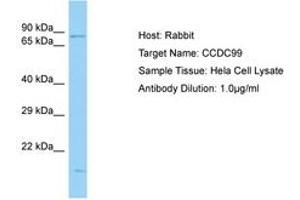 Image no. 1 for anti-Protein Spindly (SPDL1) (C-Term) antibody (ABIN6750167) (Spindly 抗体  (C-Term))