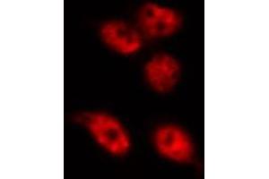 ABIN6268811 staining HeLa by IF/ICC. (RBMX 抗体  (N-Term))