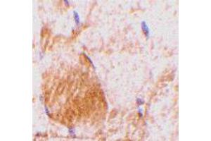 Immunohistochemistry of Il31 in rat skeletal muscle tissue with Il31 polyclonal antibody  at 10 ug/mL . (IL-31 抗体  (N-Term))