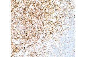 Immunohistochemistry (IHC) image for anti-CD5 (CD5) (AA 445-495) antibody (ABIN7454003)