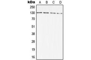 Western blot analysis of DIAPH2 expression in A431 (A), HCT116 (B), SP2/0 (C), PC12 (D) whole cell lysates. (DIAPH2 抗体  (Center))