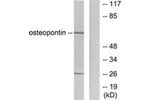 Western blot analysis of extracts from LOVO cells, using Osteopontin Antibody. (Osteopontin 抗体  (AA 261-310))
