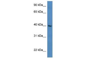 WB Suggested Anti-ZNF821 Antibody Titration:  0. (ZNF821 抗体  (N-Term))