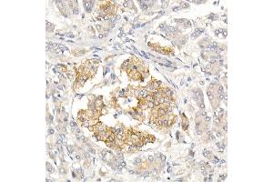 Immunohistochemistry of paraffin-embedded Human islet using CD99 Rabbit pAb (ABIN3022730, ABIN3022731, ABIN3022732, ABIN1512728 and ABIN6219199) at dilution of 1:50 (40x lens). (CD99 抗体  (AA 23-185))