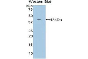 Western Blotting (WB) image for anti-Complement Component 8, beta Polypeptide (C8B) (AA 161-503) antibody (ABIN3206898) (C8B 抗体  (AA 161-503))
