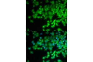 Immunofluorescence analysis of U2OS cells using NCF4 antibody (ABIN5971122). (NCF4 抗体)