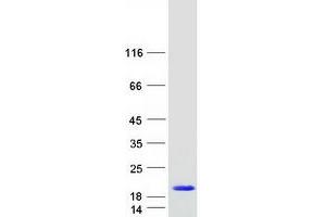 Western Blotting (WB) image for Mediator Complex Subunit 10 (MED10) protein (Myc-DYKDDDDK Tag) (ABIN2725754)