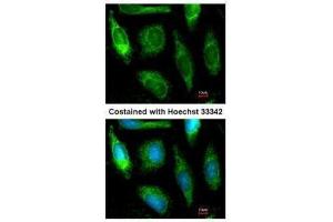 ICC/IF Image Immunofluorescence analysis of methanol-fixed HeLa, using ALDH1A1, antibody at 1:200 dilution. (ALDH1A1 抗体  (C-Term))