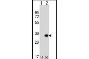 Western blot analysis of GCLM (arrow) using rabbit polyclonal GCLM Antibody (C-term) (ABIN653046 and ABIN2842657). (GCLM 抗体  (C-Term))