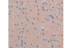IHC-P analysis of Mouse Tissue, with DAB staining. (ICAM5 抗体  (AA 164-441))