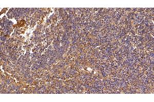 Detection of IL8 in Porcine Lymph node Tissue using Polyclonal Antibody to Interleukin 8 (IL8) (IL-8 抗体  (AA 23-101))