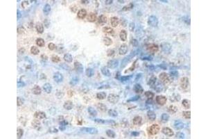 Immunohistochemical analysis of paraffin-embedded human fetal kidney showing cytoplasmic staining with ABHD12B polyclonal antibody  at a 1 : 100 dilution. (ABHD12B 抗体  (AA 78-284))