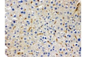 IHC testing of FFPE mouse liver with BMP5 antibody. (BMP5 抗体)