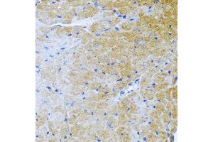 Immunohistochemistry (Paraffin-embedded Sections) (IHC (p)) image for anti-Bone Morphogenetic Protein 3 (BMP3) (AA 243-472) antibody (ABIN6137597)