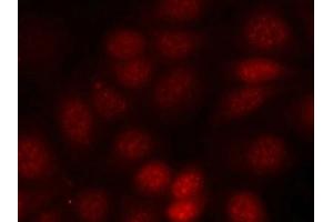Immunofluorescence staining of methanol-fixed MCF cells using p70 S6 Kinase(Phospho-Thr421) Antibody.
