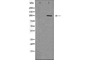 Western blot analysis of extracts from Jurkat , using TLR3 antibody. (TLR3 抗体  (C-Term))