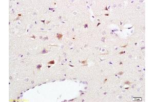 Formalin-fixed and paraffin embedded rat brain tissue labeled Anti-NCAM1 Polyclonal Antibody, Unconjugated  at 1:200, followed by conjugation to the secondary antibody and DAB staining (CD56 抗体  (AA 701-800))