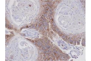 AP31121PU-N ANXA7 antibody staining of paraffin-embedded Cal27 xenograft at 1/1000 dilution. (Annexin VII 抗体  (AA 122-419))