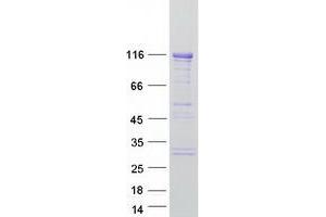 Validation with Western Blot