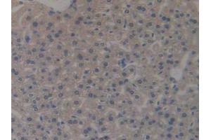 IHC-P analysis of Mouse Liver Tissue, with DAB staining. (MUC1 抗体  (AA 474-630))