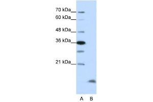 Western Blot showing CCNB3 antibody used at a concentration of 1-2 ug/ml to detect its target protein. (Cyclin B3 抗体  (N-Term))