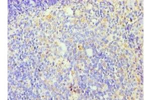 Immunohistochemistry of paraffin-embedded human tonsil tissue using ABIN7176253 at dilution of 1:100 (ZNF346 抗体  (AA 1-294))