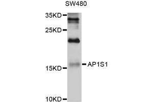 Western blot analysis of extracts of SW480 cells, using AP1S1 antibody. (AP1S1 抗体)