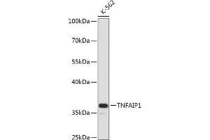 Western blot analysis of extracts of K-562 cells, using TNF antibody (ABIN7271074) at 1:1000 dilution. (TNFAIP1 抗体  (AA 90-160))