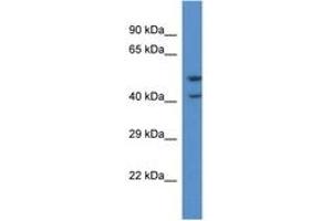 Image no. 1 for anti-Pyroglutamylated RFamide Peptide Receptor (QRFPR) (C-Term) antibody (ABIN6746840) (QRFPR 抗体  (C-Term))