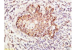 Formalin-fixed and paraffin embedded human skin labeled with Anti-RhoA Polyclonal Antibody , Unconjugated 1:400 followed by conjugation to the secondary antibody and DAB staining (RhoA, C (AA 101-193) 抗体)