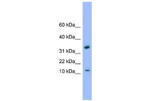 WB Suggested Anti-GABARAP Antibody Titration: 0. (GABARAP 抗体  (C-Term))