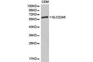 Western Blotting (WB) image for anti-Solute Carrier Family 22 Member 6 (SLC22A6) antibody (ABIN1874816)