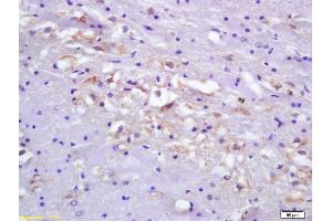 Formalin-fixed and paraffin embedded rat brain tissue labeled Anti-Ets1/ETS-1 Polyclonal Antibody, Unconjugated (ABIN674424) at 1:200, followed by conjugation to the secondary antibody and DAB staining (ETS1 抗体  (AA 321-441))