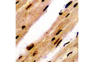 Immunohistochemical analysis of PSMB8 staining in rat heart formalin fixed paraffin embedded tissue section. (PSMB8 抗体)