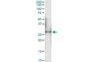 Immunoprecipitation of OSM transfected lysate using anti-OSM MaxPab rabbit polyclonal antibody and Protein A Magnetic Bead , and immunoblotted with OSM purified MaxPab mouse polyclonal antibody (B02P) . (Oncostatin M 抗体  (AA 1-252))