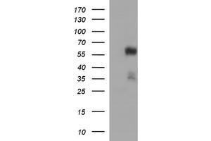Western Blotting (WB) image for anti-Tubulin, alpha 1B (TUBA1B) antibody (ABIN2715958) (TUBA1B 抗体)