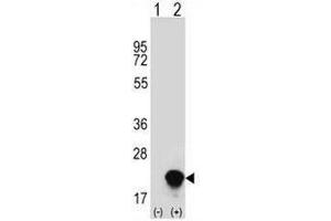 Western Blotting (WB) image for anti-Ring Finger Protein 5, E3 Ubiquitin Protein Ligase (RNF5) (AA 64-94), (Middle Region) antibody (ABIN954576)