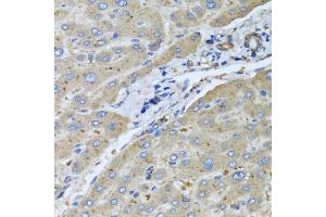 Immunohistochemistry of paraffin-embedded human liver injury using UGT2B10 antibody. (UGT2B10 抗体)