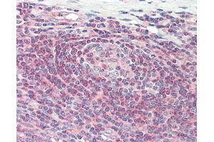 Anti-ARHGEF18 antibody IHC staining of human tonsil.