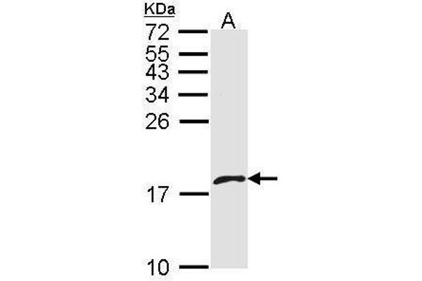 PF4V1 抗体  (C-Term)