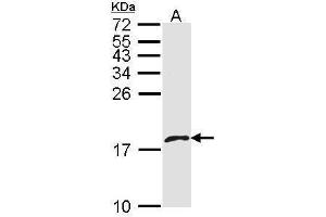 WB Image Sample (30 ug of whole cell lysate) A: A431 , 15% SDS PAGE antibody diluted at 1:1000