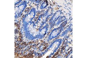IHC analysis of RAB7/RAB7A using anti-RAB7/RAB7A antibody (ABIN7600597). (RAB7A 抗体  (AA 21-177))