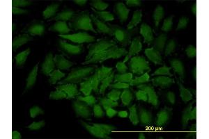 Immunofluorescence of monoclonal antibody to GJB3 on HeLa cell. (Connexin 31 抗体  (AA 1-270))