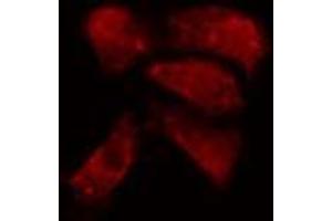 ABIN6274152 staining A549 cells by IF/ICC. (Histone H1 抗体  (Internal Region))