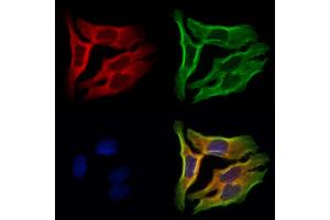 ABIN6262116 and ABIN6273047 staining Hela cells by IF/ICC. (GSTA4 抗体  (N-Term))