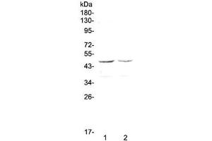 Western blot testing of human 1) HepG2 and 2) MCF7 cell lysate with GALT antibody at 0. (GALT 抗体)