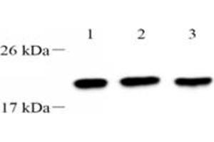 Western blot analysis of TPPP3 (ABIN7076047),at dilution of 1: 2000,Lane 1: 293 cell lysate,Lane 2: PC3 cell lysate,Lane 3: A549 cell lysate (TPPP3 抗体)