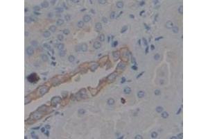 IHC-P analysis of Human Tissue, with DAB staining. (IL18R1 抗体  (AA 375-428))