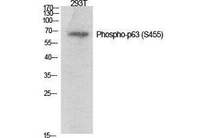 Western Blot (WB) analysis of specific cells using Phospho-p63 (S455) Polyclonal Antibody. (TCP1 alpha/CCTA 抗体  (pSer455))